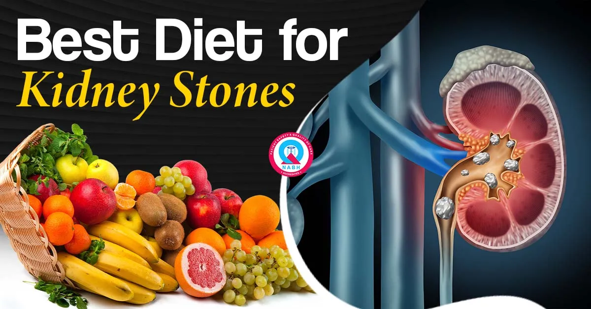 best-diet-for-kidney-stones